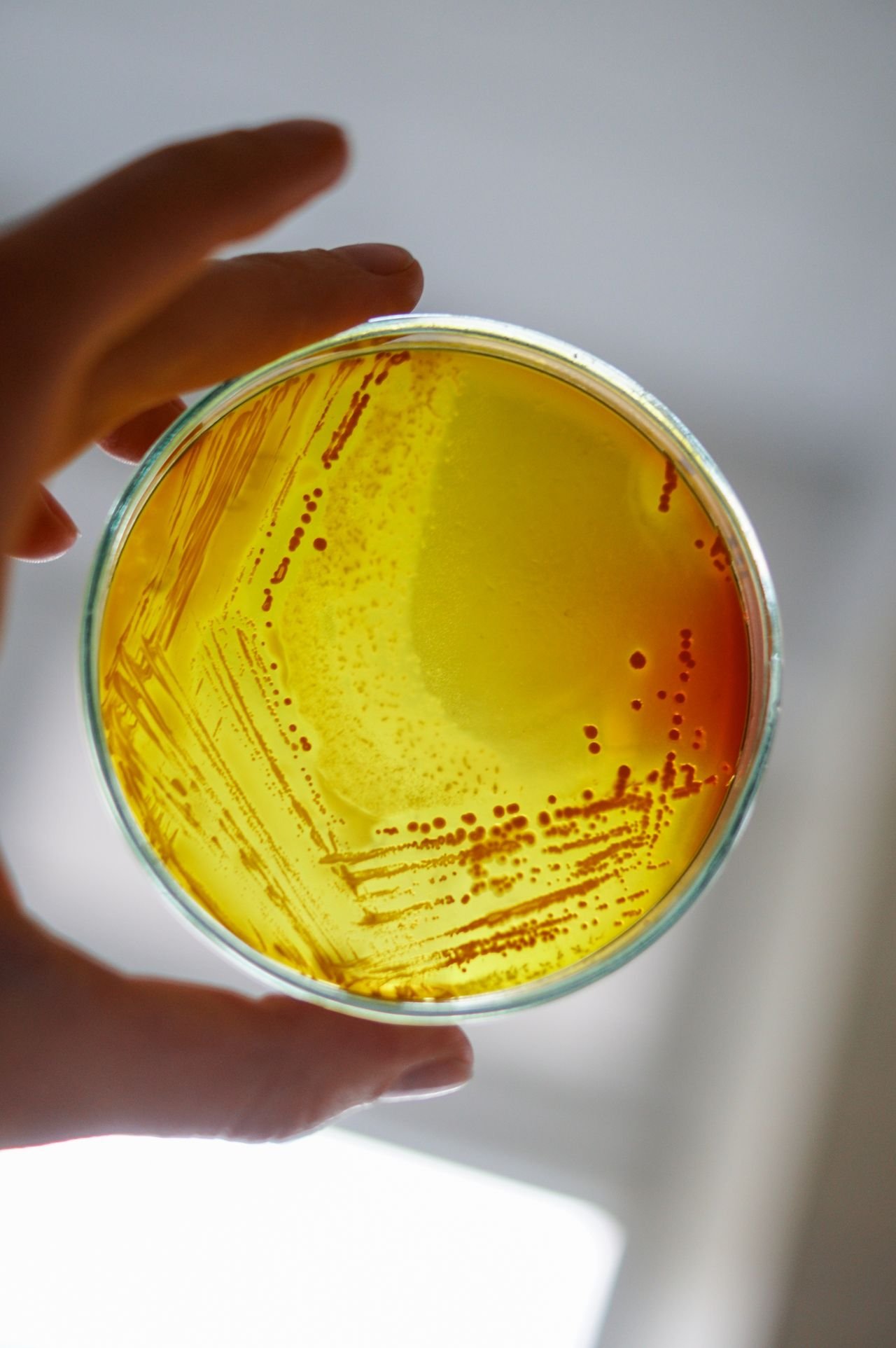 Microorganismos-microbiologia-desde-el-nucleo Microorganismos-microbiologia-desde-el-nucleo
